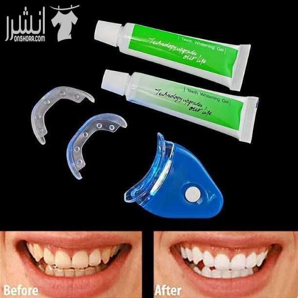 ❤️جهاز تبييض الاسنان المنزلى بالليزر❤️ سعروو 13 دينار والتوصيل مجاني 0780036355 تخلص من آثار التدخين والقهوه نهائيا خلال اسبوع بس