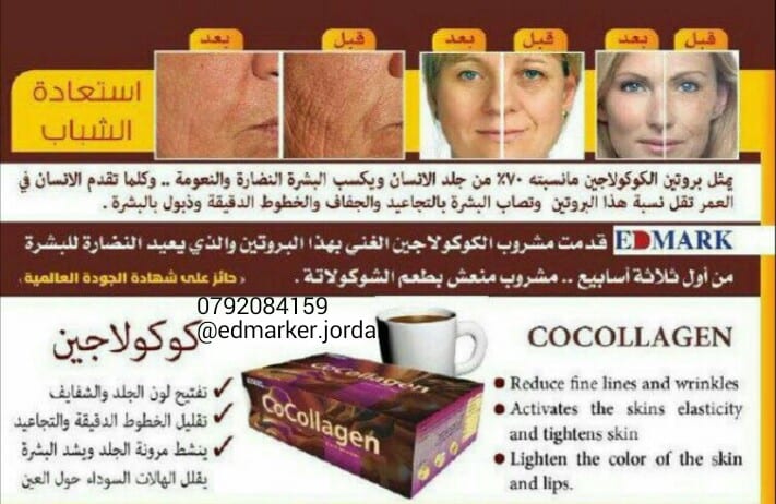 عرض خاص جدا
لا تنسَ أنك شاهدت هذا الإعلان في عنكبوت
أحصلي على بشرة رائعة متجددة ومرنة خاليه م...