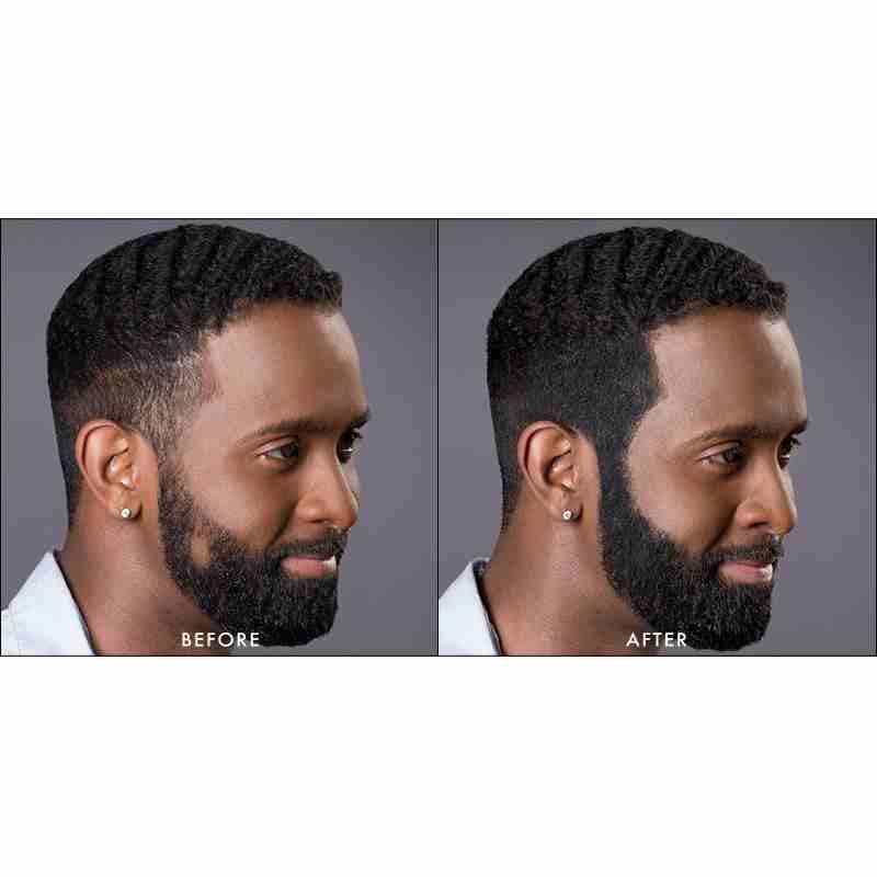 TOPPIK , Hair Building Fibers
لا تنسَ أنك شاهدت هذا الإعلان في عنكبوت
فراغات الشعر !!!
ولا يهمك...