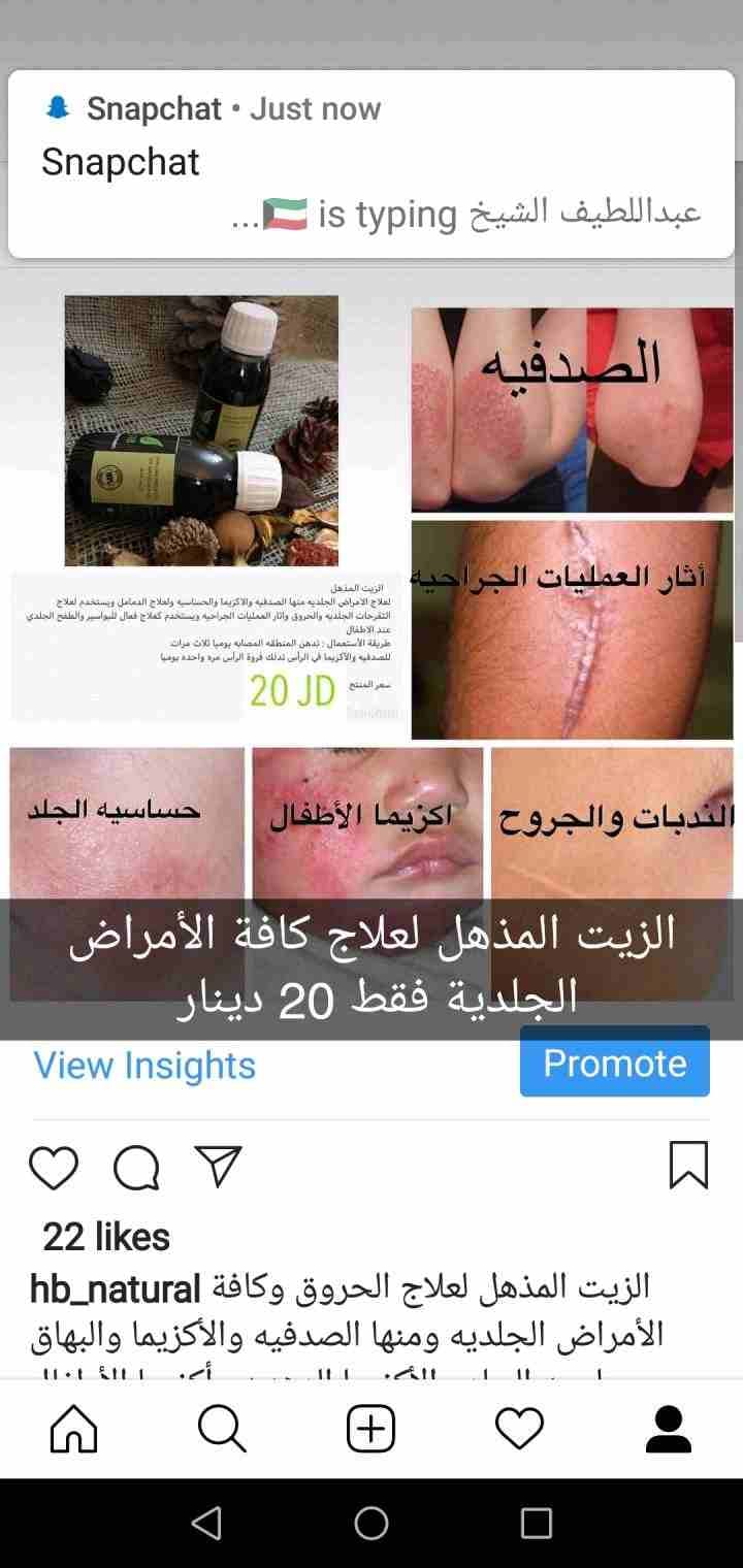 علاج الصدفيه والأكزيما وعلاج تساقط الشعر
لا تنسَ أنك شاهدت هذا الإعلان في عنكبوت
يوجد لدي منتجات...