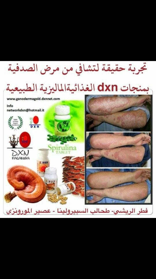 منتجات Dxn
لا تنسَ أنك شاهدت هذا الإعلان في عنكبوت
منتجاتنامفيده جدااااا ومضمونه واستعمالهاأم...