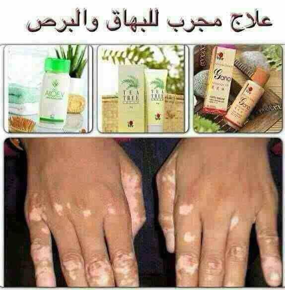 محافظة عمان
لا تنسَ أنك شاهدت هذا الإعلان في عنكبوت
مجموعة كريمات مفيده...