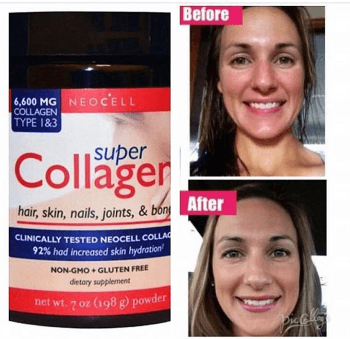 حبوب الكولاجين الأمريكية
لا تنسَ أنك شاهدت هذا الإعلان في عنكبوت
#collagen
حبوب الكولاجين ال...