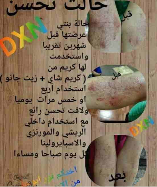 محافظة عمان
لا تنسَ أنك شاهدت هذا الإعلان في عنكبوت
مجموعة كريمات مفيده...