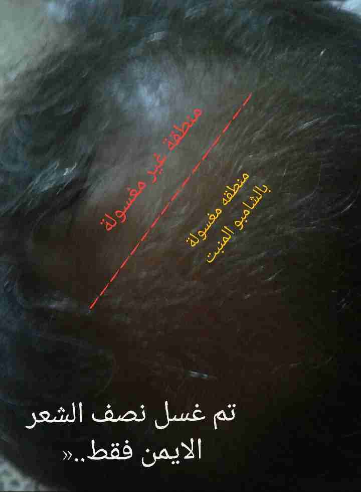 شامبو انبات الشعر القوي Repair,غير مصدق»
لا تنسَ أنك شاهدت هذا الإعلان في عنكبوت
شامبو...