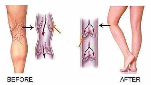 جوارب الدوالي
لا تنسَ أنك شاهدت هذا الإعلان في عنكبوت
#جوارب_طبية_لعلاج_الدوالي
#السعر_12دينار___...