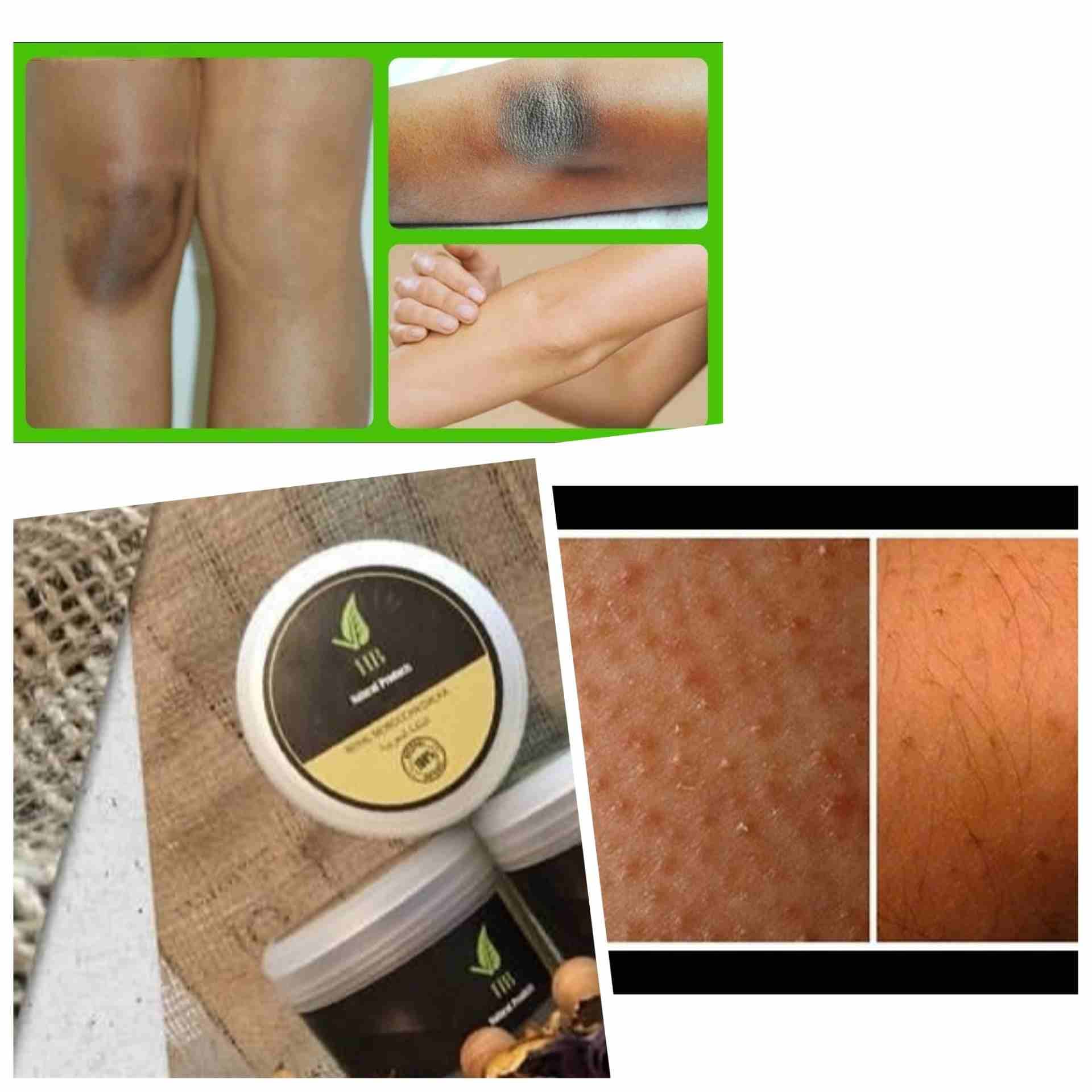 علاج الصدفيه والأكزيما وعلاج تساقط الشعر
لا تنسَ أنك شاهدت هذا الإعلان في عنكبوت
يوجد لدي منتجات...