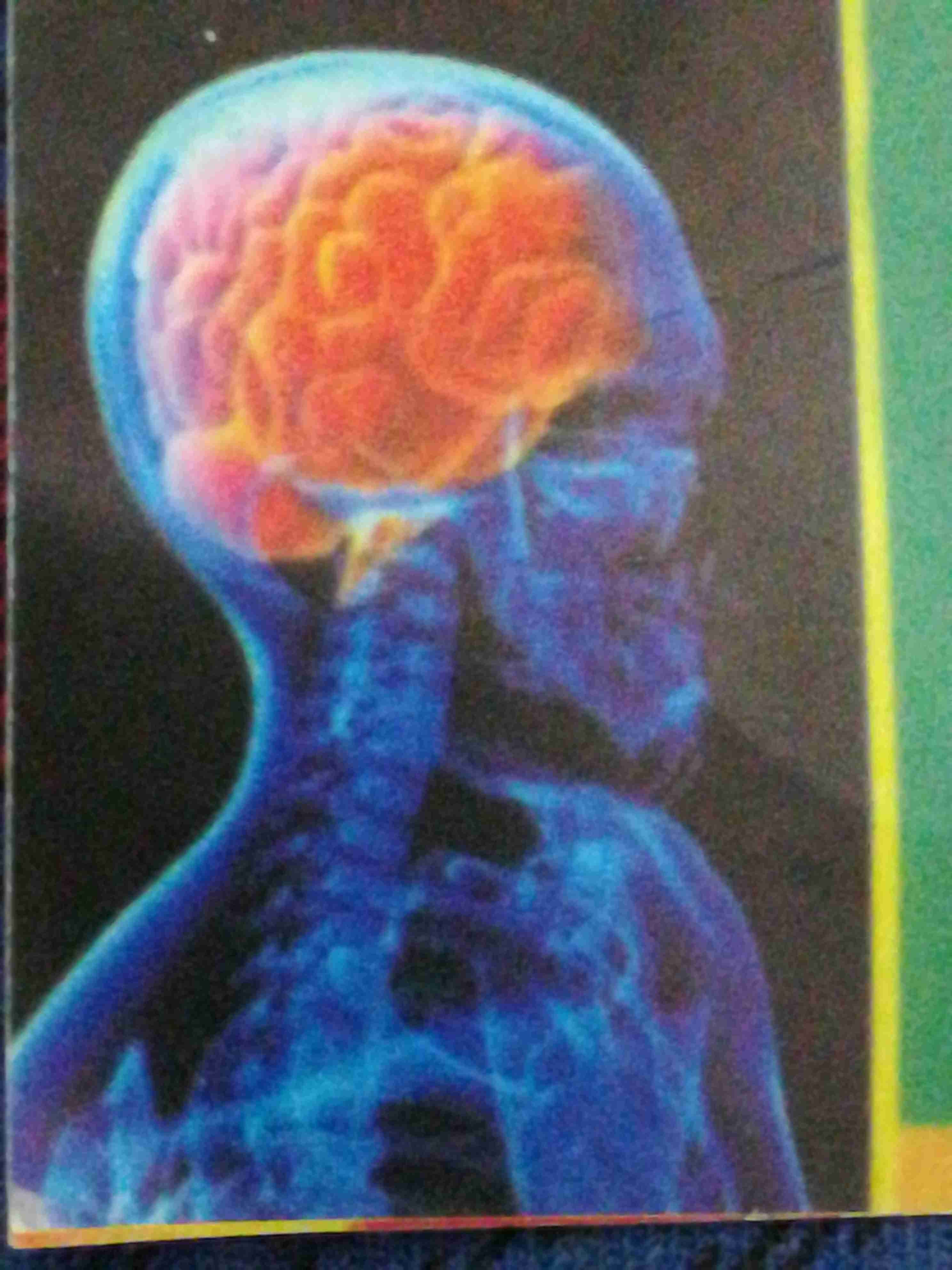 فنية تخطيط دماغ
لا تنسَ أنك شاهدت هذا الإعلان في عنكبوت
فنية تخطيط دماغ مع جهاز متنقل بخبرة 1...