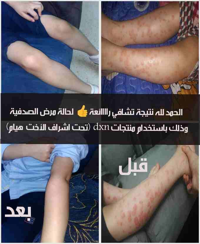 محافظة عمان
لا تنسَ أنك شاهدت هذا الإعلان في عنكبوت
مجموعة كريمات مفيده...