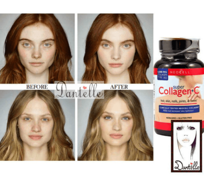 حبوب الكولاجين الأمريكية
لا تنسَ أنك شاهدت هذا الإعلان في عنكبوت
#collagen
حبوب الكولاجين ال...
