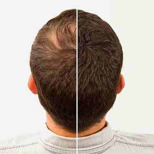 Dexe Hair
لا تنسَ أنك شاهدت هذا الإعلان في عنكبوت
الياف DEXEلإعاده بناء الشعر الحل الأمثل للرجال...