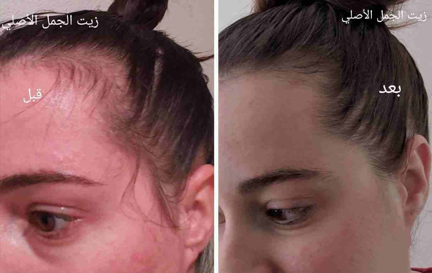 شعرك بكت ؟🙄
عندك فراغات كبيرة بشعرك ؟😔
عندك مشكلة بأنبات الشعر ؟🤔
الحل موجوووود 🤗😍ومضمون 100%🤩
زيت الجمل
☘️يعالج مشكلة تساقط الشعر التي يعاني منها الكثيرين نساء كانو او رجال ويقوي البصيلات ويع...