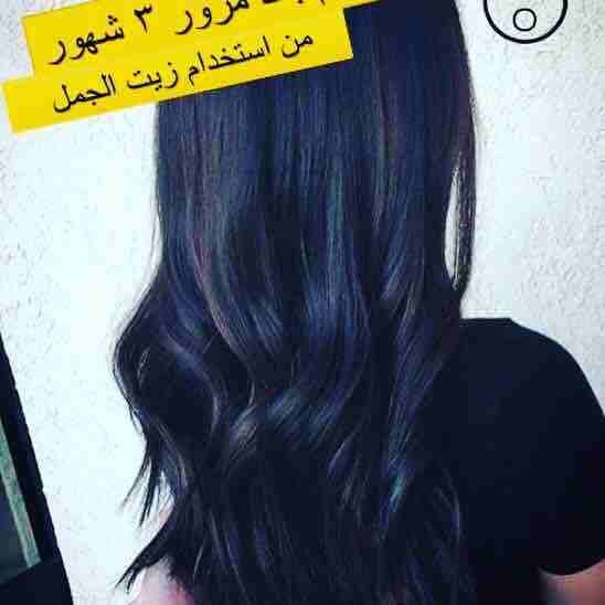 شعرك بكت ؟🙄
عندك فراغات كبيرة بشعرك ؟😔
عندك مشكلة بأنبات الشعر ؟🤔
الحل موجوووود 🤗😍ومضمون 100%🤩
زيت الجمل
☘️يعالج مشكلة تساقط الشعر التي يعاني منها الكثيرين نساء كانو او رجال ويقوي البصيلات ويع...