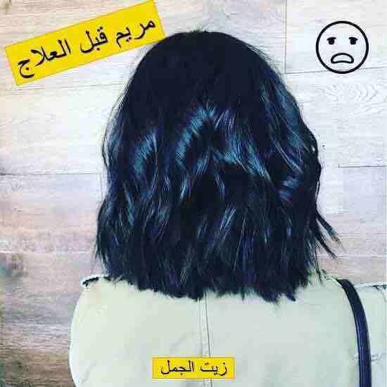 شعرك بكت ؟🙄
عندك فراغات كبيرة بشعرك ؟😔
عندك مشكلة بأنبات الشعر ؟🤔
الحل موجوووود 🤗😍ومضمون 100%🤩
زيت الجمل
☘️يعالج مشكلة تساقط الشعر التي يعاني منها الكثيرين نساء كانو او رجال ويقوي البصيلات ويع...
