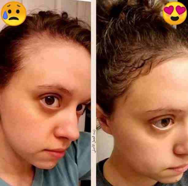 شعرك بكت ؟🙄
عندك فراغات كبيرة بشعرك ؟😔
عندك مشكلة بأنبات الشعر ؟🤔
الحل موجوووود 🤗😍ومضمون 100%🤩
زيت الجمل
☘️يعالج مشكلة تساقط الشعر التي يعاني منها الكثيرين نساء كانو او رجال ويقوي البصيلات ويع...