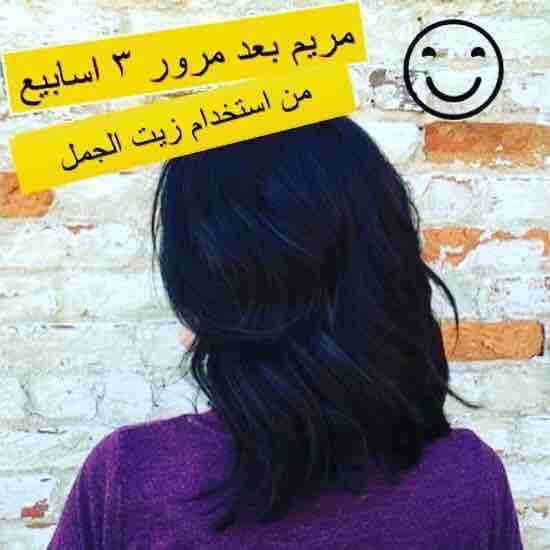 شعرك بكت ؟🙄
عندك فراغات كبيرة بشعرك ؟😔
عندك مشكلة بأنبات الشعر ؟🤔
الحل موجوووود 🤗😍ومضمون 100%🤩
زيت الجمل
☘️يعالج مشكلة تساقط الشعر التي يعاني منها الكثيرين نساء كانو او رجال ويقوي البصيلات ويع...