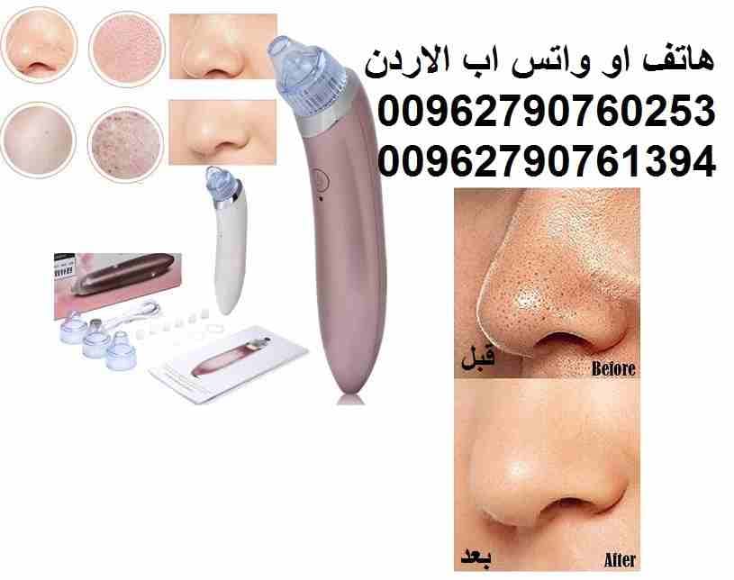 إزالة الزيوان من الوجه والأنف طرق إزالة الزيوان التخلص من الزوان وتنظيف البشرة وازالة الرؤوس السوداء و الخلايا الميتة و الاوساخ من الجلد يساعد على تقشير خلايا الجلد الميت و شفطه Electric blackhead Suc...