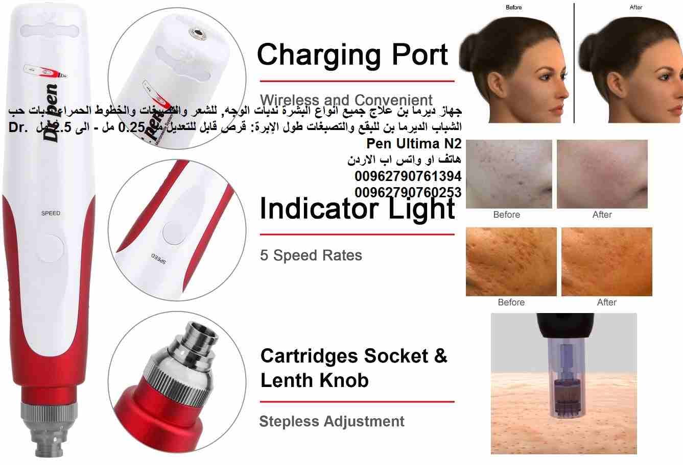 ديرما بن علاج جميع أنواع البشرة ندبات الوجه, للشعر والتصبغات والخطوط الحمراء ندبات حب الشباب الديرما بن للبقع والتصبغات طول الإبرة: قرص قابل للتعديل من 0.25 مل - الى 2.5 مل Dr. Pen Ultima N2
جهاز الدي...