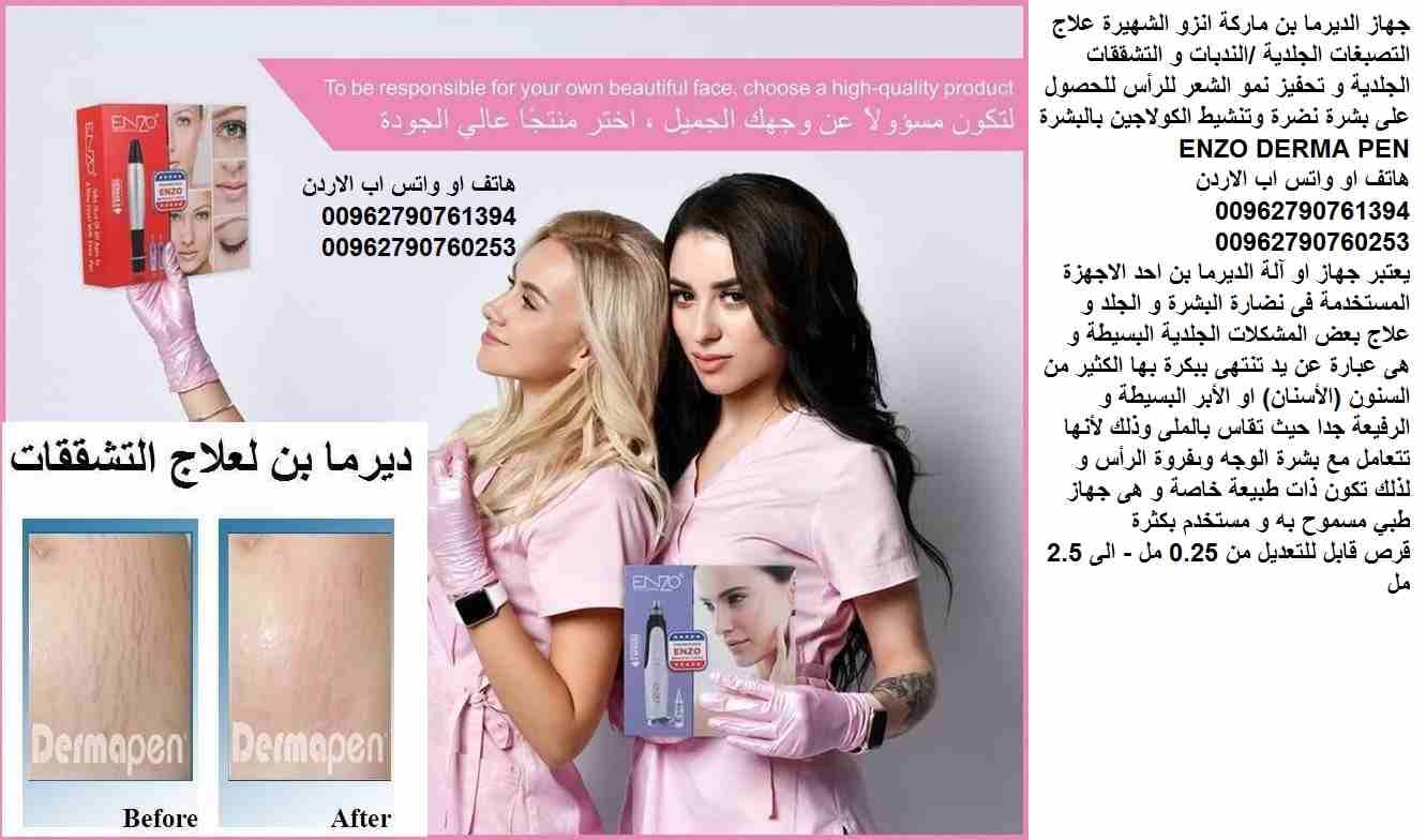 علاج التصبغات الجلدية ... التشققات الجلدية / علاج الندبات جهاز الديرما بن ماركة اينزو الشهيرة علاج التصبغات الجلدية /الندبات و التشققات الجلدية و تحفيز نمو الشعر للرأس للحصول على بشرة نضرة وتنشيط الكو...