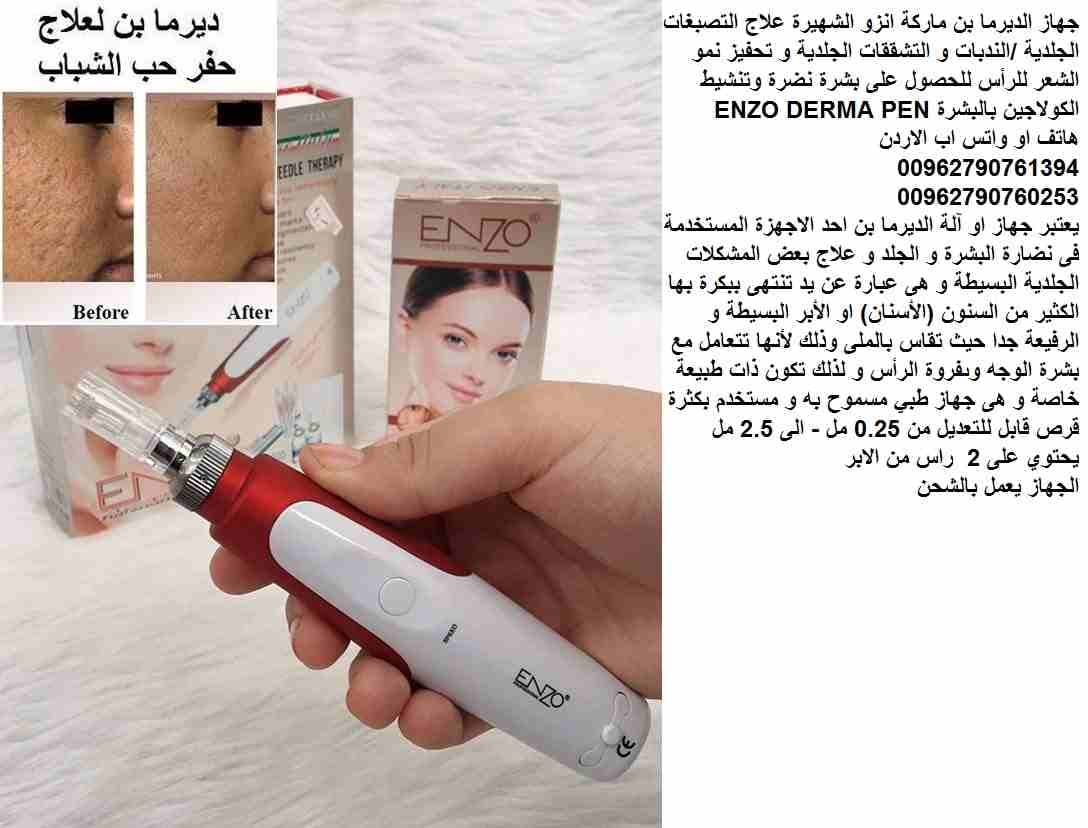 علاج التصبغات الجلدية ... التشققات الجلدية / علاج الندبات جهاز الديرما بن ماركة اينزو الشهيرة علاج التصبغات الجلدية /الندبات و التشققات الجلدية و تحفيز نمو الشعر للرأس للحصول على بشرة نضرة وتنشيط الكو...