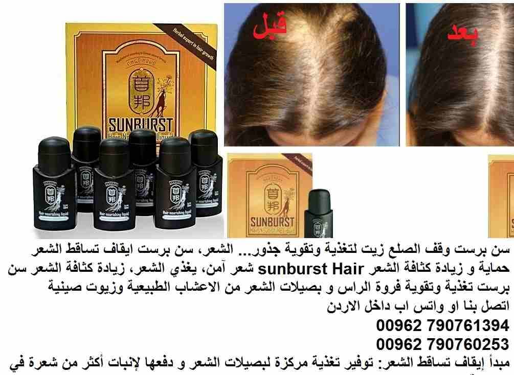 علاج تساقط الشعر | اعادة نمو الشعر؟ سن برست وقف الصلع زيت لتغذية وتقوية جذور( علاج الصلع ) ... الشعر، سن برست ايقاف تساقط الشعر حماية و زيادة كثافة الشعر sunburst Hair شعر آمن، يغذي الشعر، زيادة كثاف...