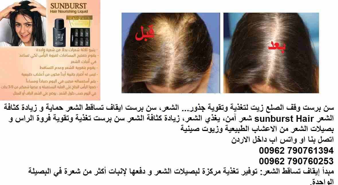 علاج تساقط الشعر | اعادة نمو الشعر؟ سن برست وقف الصلع زيت لتغذية وتقوية جذور( علاج الصلع ) ... الشعر، سن برست ايقاف تساقط الشعر حماية و زيادة كثافة الشعر sunburst Hair شعر آمن، يغذي الشعر، زيادة كثاف...