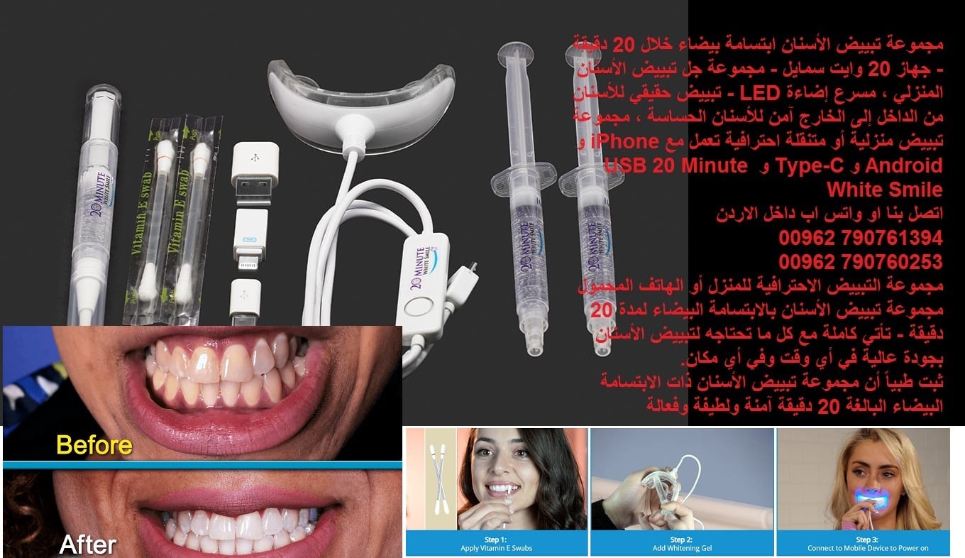 جهاز طبي احصل على ابتسامة هوليود حل سريع لأسنان ناصعة البياض تدوم طويلاً تبييض الأسنان ابتسامة هوليود بيضاء خلال 20 دقيقة - جهاز 20 وايت سمايل - مجموعة جل تبييض الأسنان المنزلي ، مسرع إضاءة LED