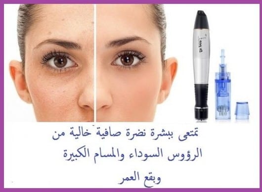 ديرما بن جهاز ديرما بن الاصلي من شركة اينزو
تعتبر جهاز أو آلة الديرما بن هو احد الأجهزة المستخدمة فى نضارة البشرة والجلد