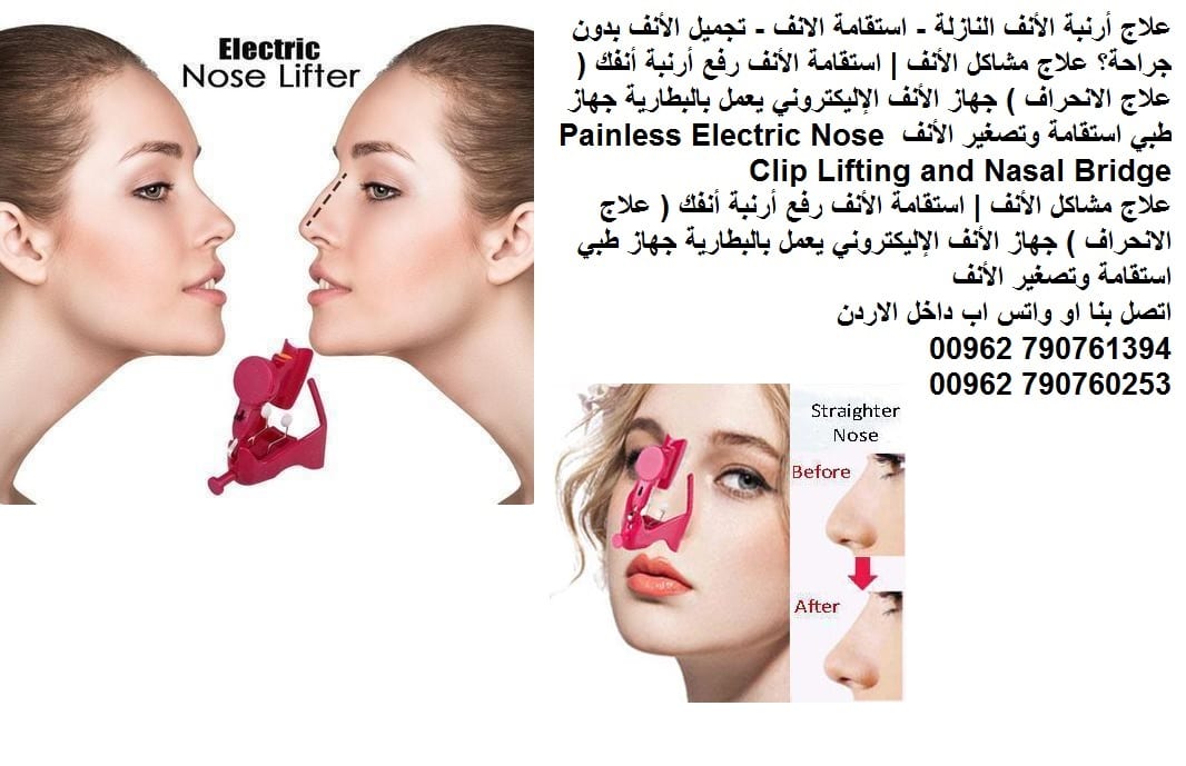 علاج ارنبة الأنف النازلة رفعها للاعلى - استقامة الانف - تجميل الأنف بدون جراحة؟ علاج مشاكل الأنف | استقامة الأنف رفع أرنبة أنفك ( علاج الانحراف ) جهاز الأنف الإليكتروني يعمل بالبطارية جهاز طبي استقامة...