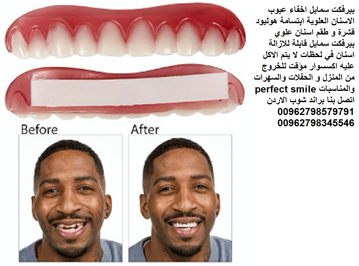 تركيب اسنان علوية بيرفكت سمايل اسنان اكسسوار : perfect smile اعمل تجميل لاسنانك بطريقة احترافية تركيب وتجميل لاسنانك فقط خلال 30 ثانية