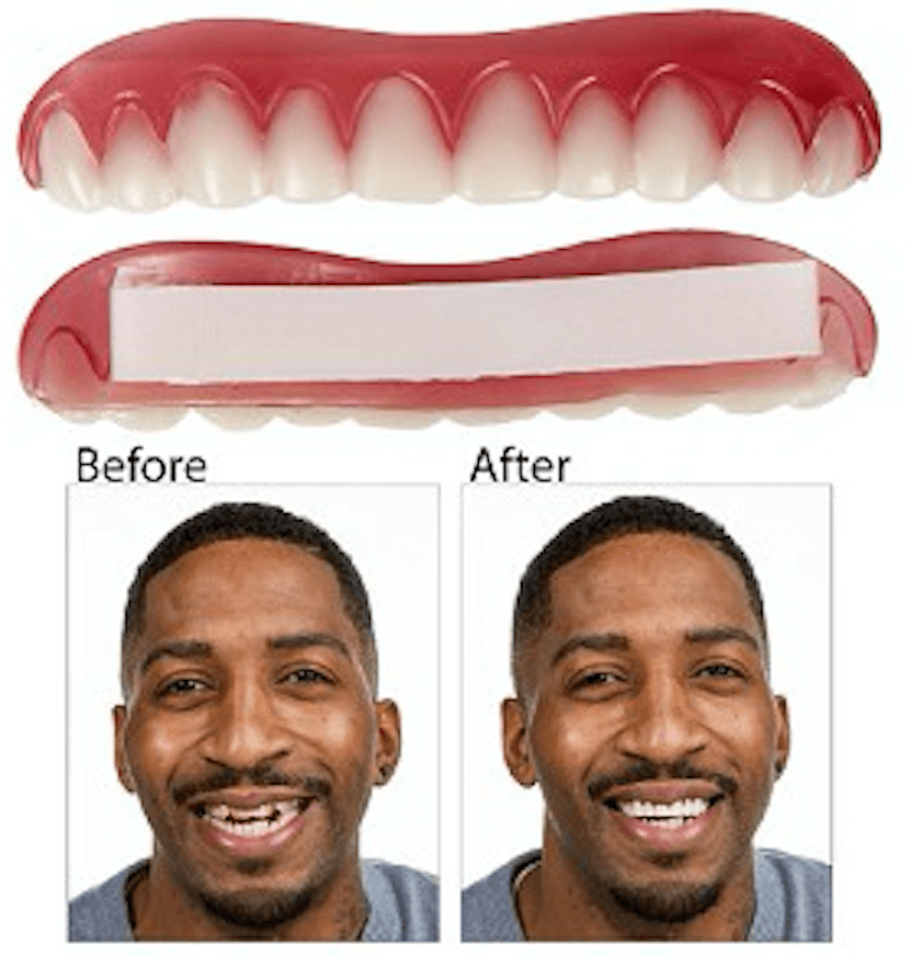 ابتسامة علوية Perfect Smile اسنان اكسسوار علوية الابتسامة المثالية قشرة و طقم الاسنان