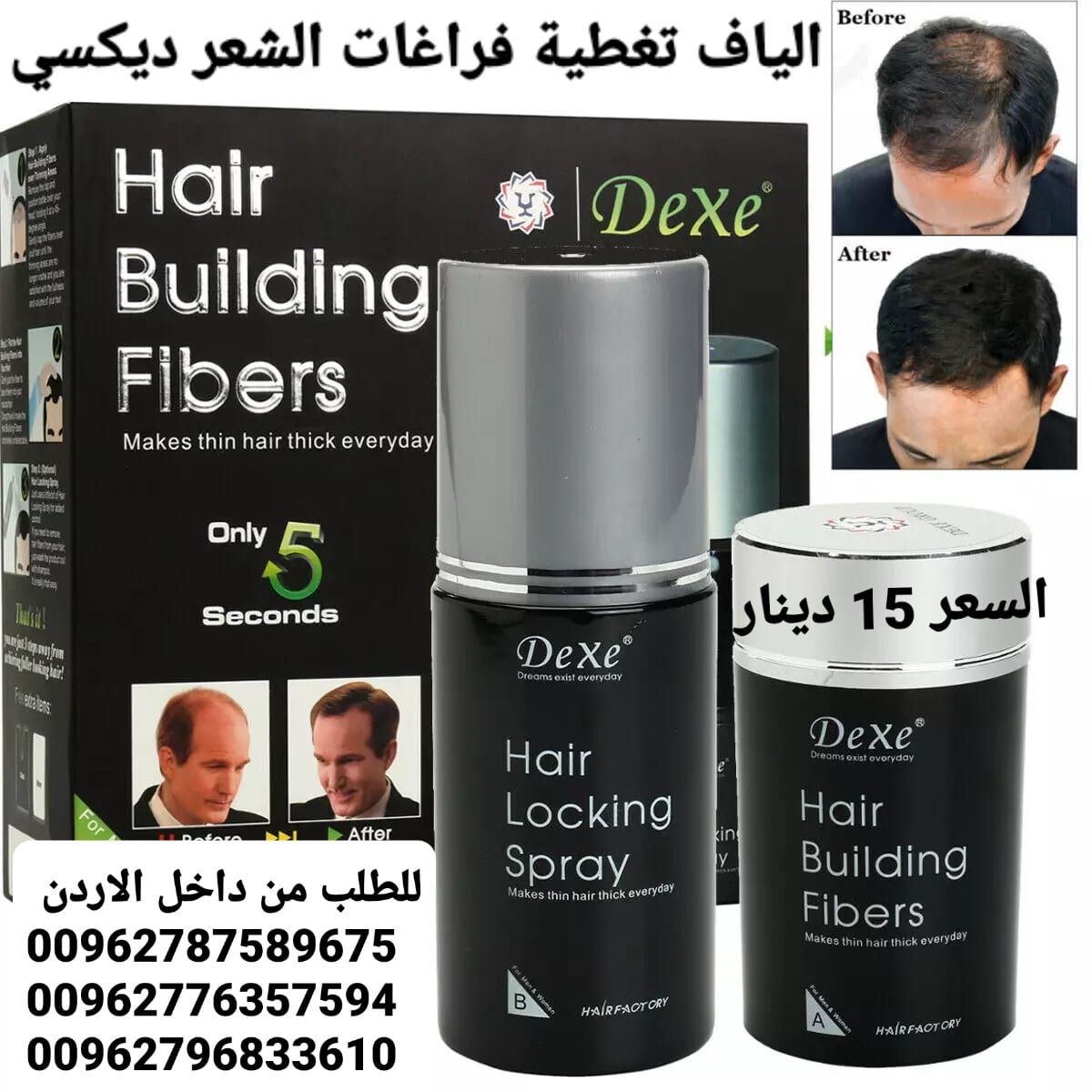 الحل الفوري للشعر الخفيف والصلع. والحل السريع والفعال