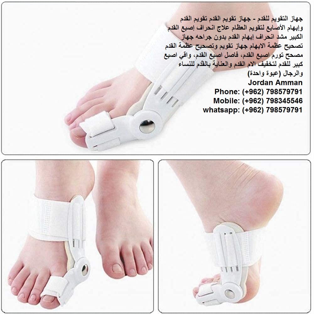 اعوجاج أصبع القدم الكبير طريقة تعديل انحراف إصبع القدم الكبير تصحيح عظمة القدم - جهاز التقويم للقدم