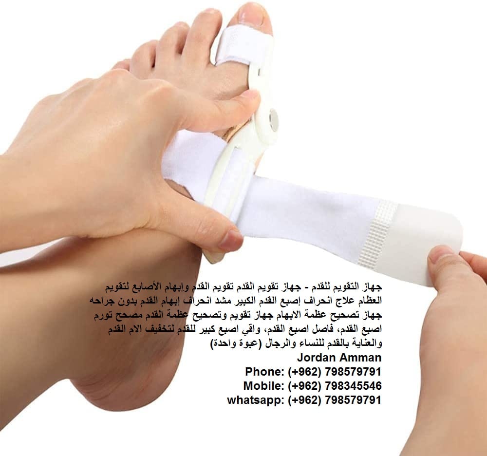 اعوجاج أصبع القدم الكبير طريقة تعديل انحراف إصبع القدم الكبير تصحيح عظمة القدم - جهاز التقويم للقدم