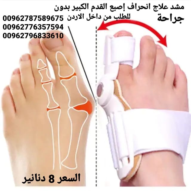 علاج انحراف إصبع القدم الكبير بدون جراحة علاج اعوجاج إبهام القدم مشد طبي القدم علاج اصبع القدم