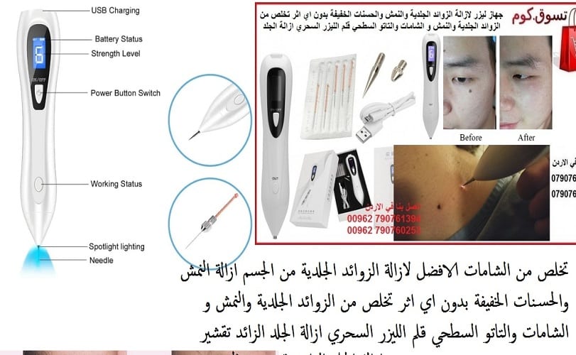 جهاز طبي ازالة زوائد الجلد و نمش الوجه يمكن علاج النمش وتجديد الجلد بواسطة استخدام