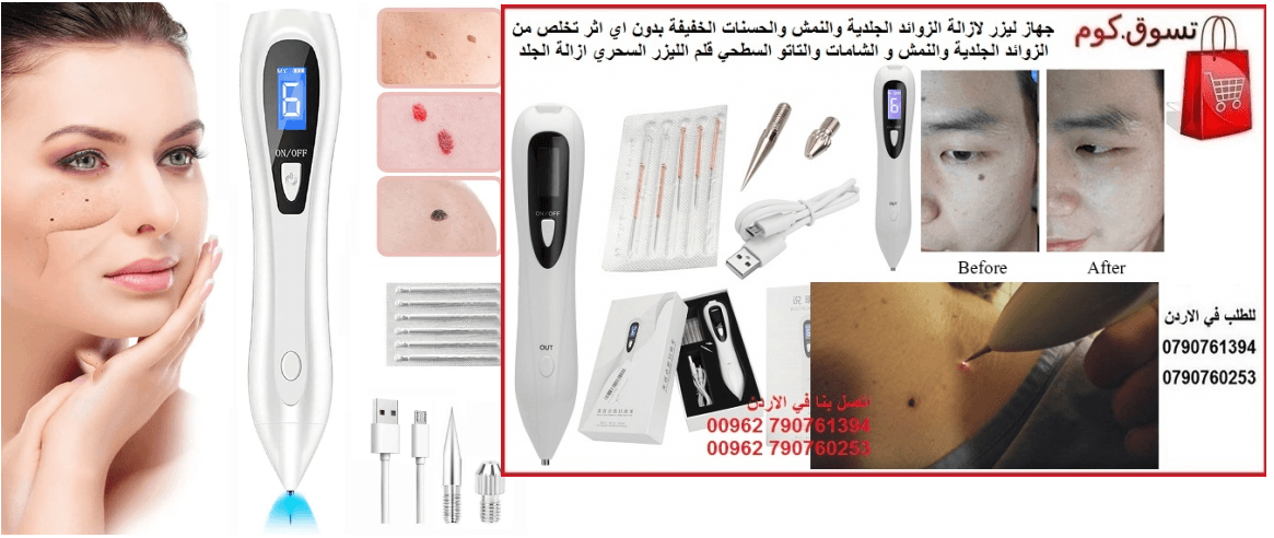 الافضل لازالة الزوائد الجلدية من الجسم ازالة النمش والحسنات الخفيفة بدون اي اثر تخلص من الزوائد الجلدية