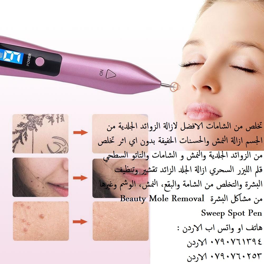 جهاز طبي ازالة زوائد الجلد و نمش الوجه يمكن علاج النمش وتجديد الجلد بواسطة استخدام