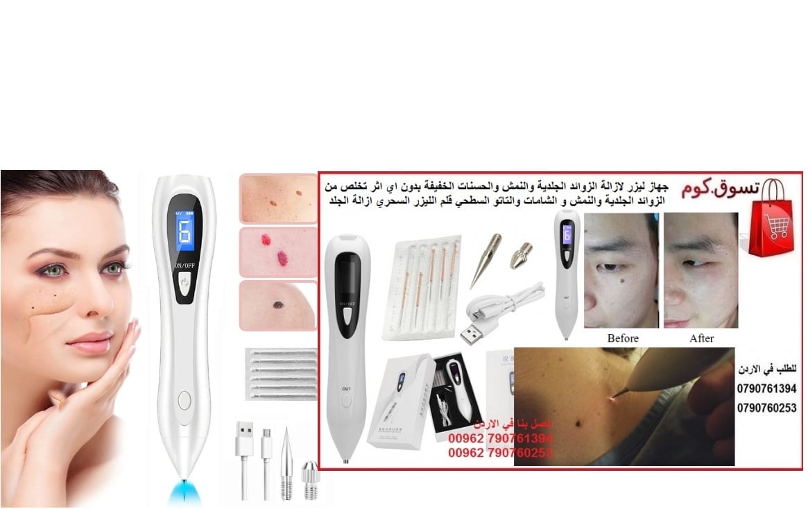 جهاز طبي ازالة زوائد الجلد و نمش الوجه يمكن علاج النمش وتجديد الجلد بواسطة استخدام