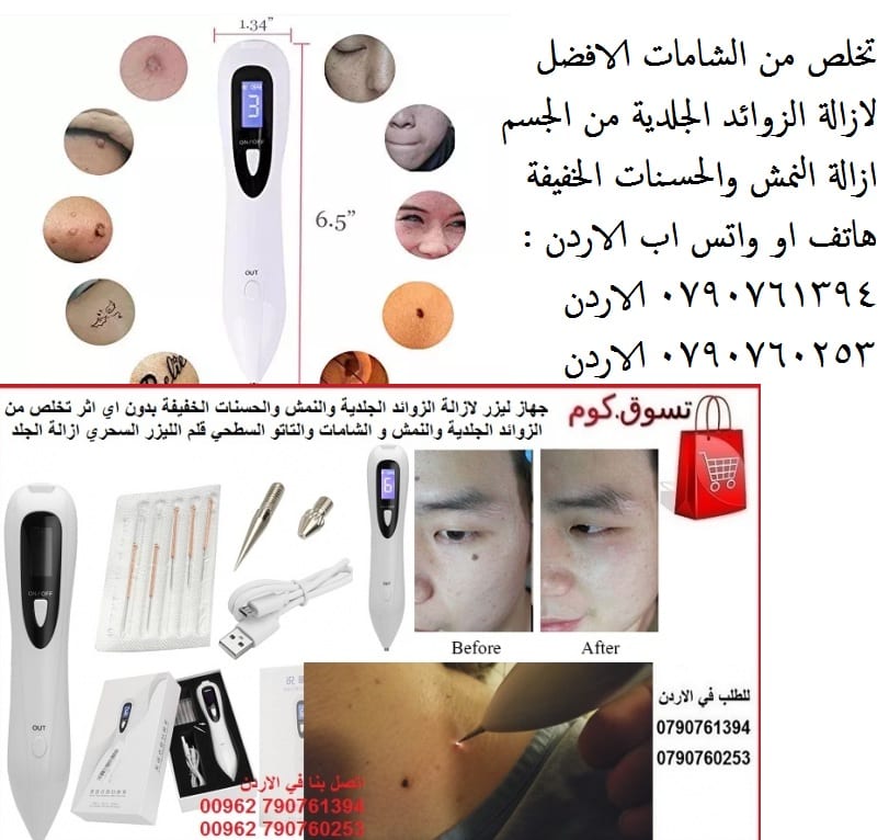 جهاز طبي ازالة زوائد الجلد و نمش الوجه يمكن علاج النمش وتجديد الجلد بواسطة استخدام