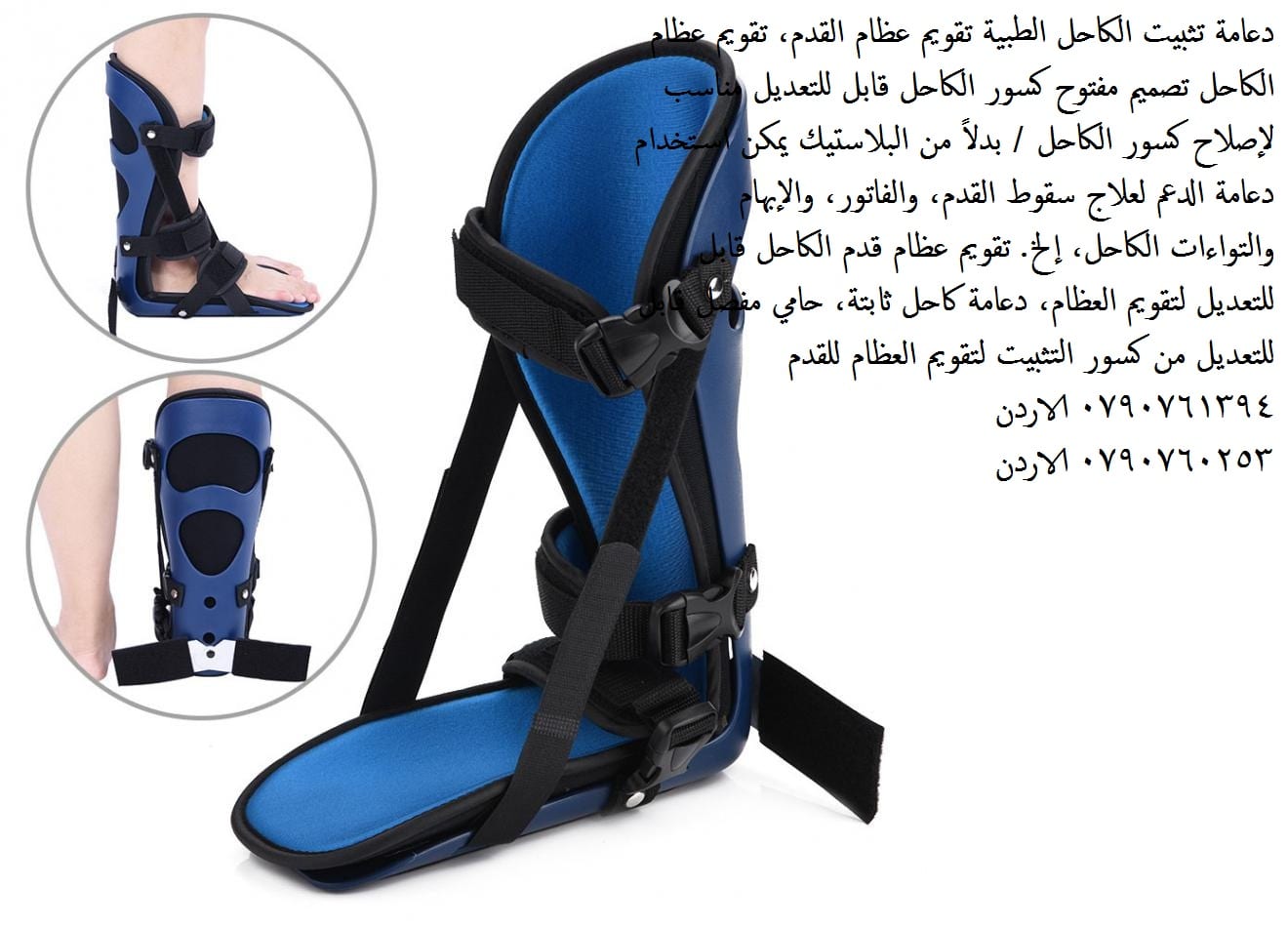 منتجات طبية للقدم دعامة تثبيت الكاحل الطبية تقويم عظام القدم، تقويم عظام الكاحل تصميم مفتوح كسور الكاحل