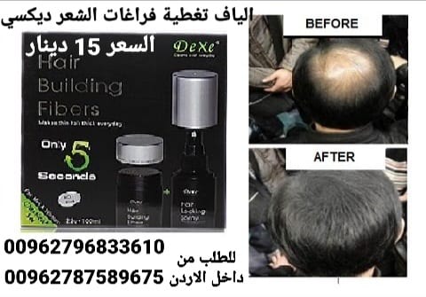 الياف تغطية فراغات الشعر الخفيف والصلع ديكسي عند الرجال والنساء