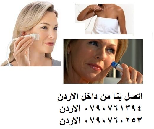 تقشير البشرة وحول العينين: جهاز التقشير الماسي انزو - يحتوي الجهاز على 3 رؤوس تقشير الوجه