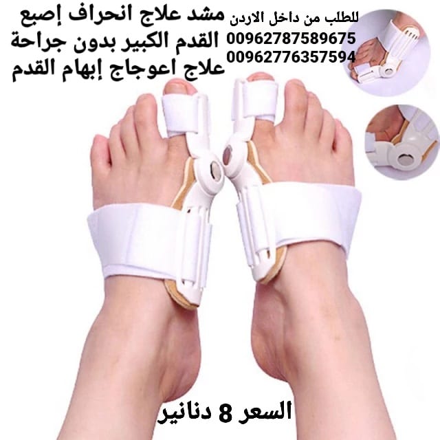 علاج بروز إبهام القدم بدون جراحة جهاز تقويم اصبع القدم الكبير .