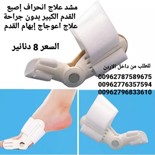 علاج بروز إبهام القدم بدون جراحة جهاز تقويم اصبع القدم الكبير .