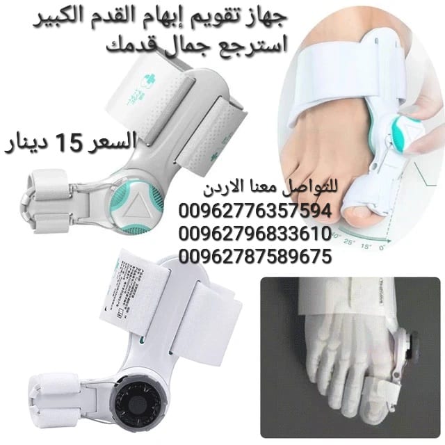 جهاز مصحح ابهام القدم الكبير يمكن أن تساعد الأداه في إصلاح تداخل أصابع القدم وأصابع القدم الملتوية ومشاكل القدم جهاز تعديل عظمة القدم الكبير